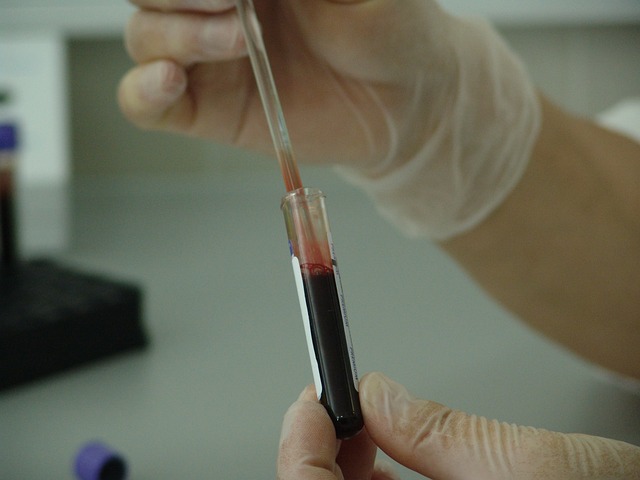 vyšetření krve